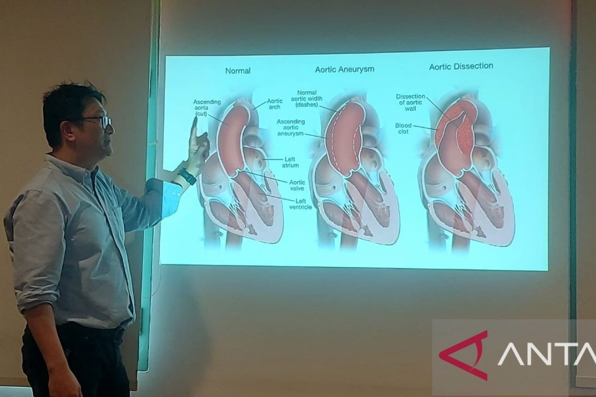 Dokter: Nyeri dada seperti ditusuk tanda ada robekan dinding aorta